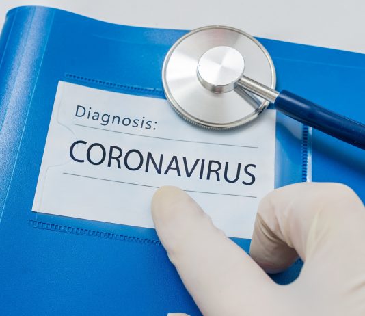 Coronavirus and Energy Demand